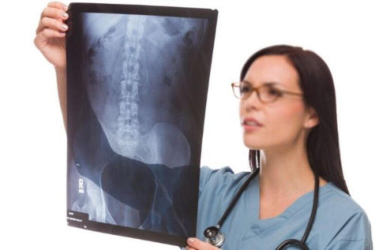 Chụp X-quang giúp xác định chính xác nguyên nhân gây đau cột sống lưng